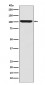 Anti-LGR5/GPR49 Rabbit Monoclonal Antibody